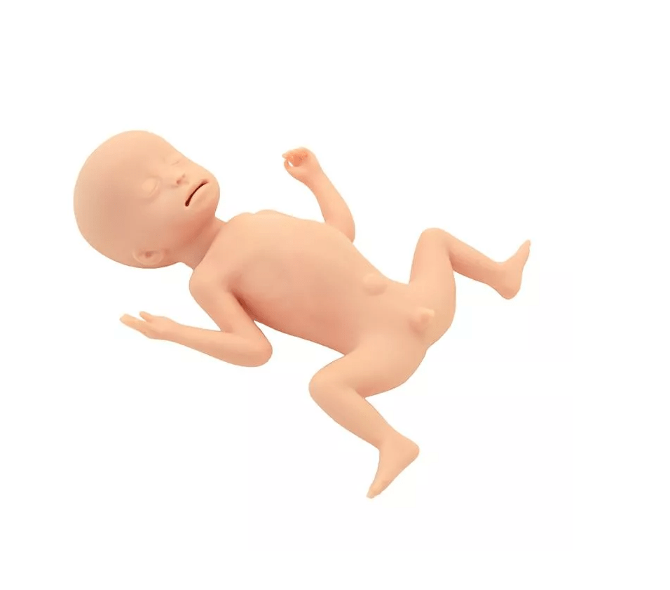 Frühgeborenes mit extrem niedrigem Geburtsgewicht (ELBW) - Erler - Zimmer